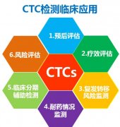 深圳CTC循环肿瘤细胞检测机构，去哪里能做肿瘤